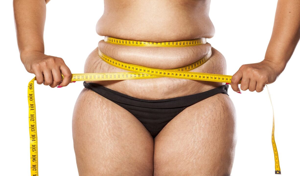 Übergewicht und Gewichtsverlust unter Verwendung von Keto Probiotix